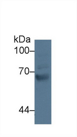 GRK4 Antibody - Western Blot; Sample: Human Jurkat cell lysate; Primary Ab: 3µg/ml Rabbit Anti-Human GRK4 Antibody Second Ab: 0.2µg/mL HRP-Linked Caprine Anti-Rabbit IgG Polyclonal Antibody