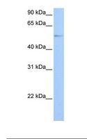 GRK4 Antibody - Jurkat cell lysate. Antibody concentration: 1.0 ug/ml. Gel concentration: 12%.  This image was taken for the unconjugated form of this product. Other forms have not been tested.