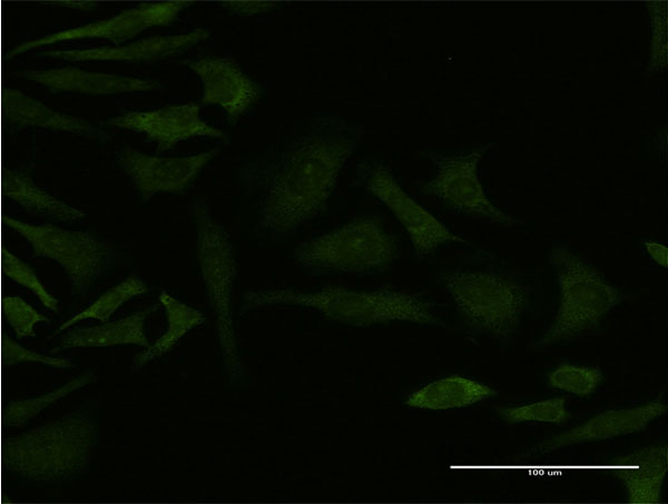 GRK4 Antibody - Immunofluorescence of monoclonal antibody to GRK4 on HeLa cell . [antibody concentration 10 ug/ml]