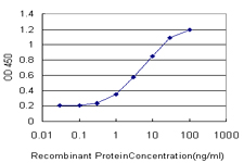 GRK4 Antibody - Detection limit for recombinant GST tagged GRK4 is approximately 0.3 ng/ml as a capture antibody.