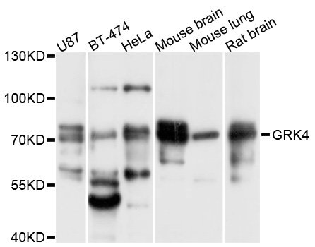 GRK4 Antibody - Western blot analysis of extracts of various cell lines, using GRK4 antibody at 1:1000 dilution. The secondary antibody used was an HRP Goat Anti-Rabbit IgG (H+L) at 1:10000 dilution. Lysates were loaded 25ug per lane and 3% nonfat dry milk in TBST was used for blocking. An ECL Kit was used for detection and the exposure time was 1s.