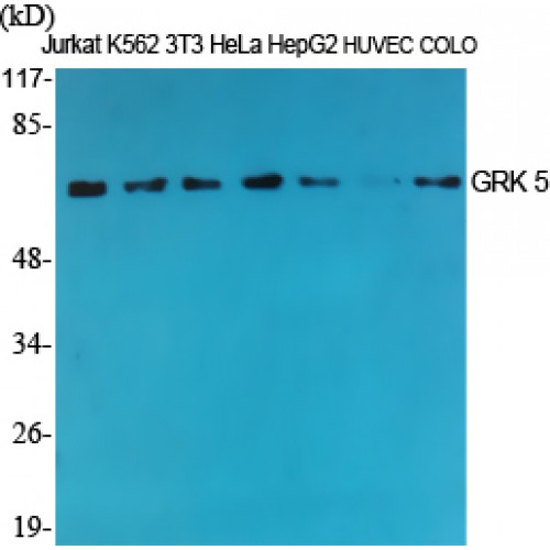 GRK5 Antibody - Western blot of GRK 5 antibody