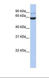 GRK5 Antibody - Fetal brain lysate. Antibody concentration: 1.0 ug/ml. Gel concentration: 12%.  This image was taken for the unconjugated form of this product. Other forms have not been tested.