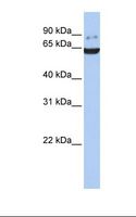 GRK5 Antibody - Fetal brain lysate. Antibody concentration: 1.0 ug/ml. Gel concentration: 12%.  This image was taken for the unconjugated form of this product. Other forms have not been tested.