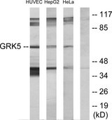 GRK5 Antibody - Western blot analysis of lysates from HeLa, HepG2, and HUVEC cells, using GRK5 Antibody. The lane on the right is blocked with the synthesized peptide.