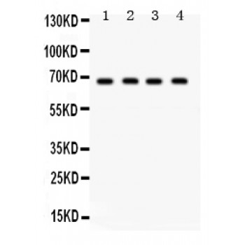 GRK5 Antibody - GRK5 antibody Western blot. All lanes: Anti GRK5 at 0.5 ug/ml. Lane 1: Rat Lung Tissue Lysate at 50 ug. Lane 2: HELA Whole Cell Lysate at 40 ug. Lane 3: HEPG2 Whole Cell Lysate at 40 ug. Lane 4: SMMC Whole Cell Lysate at 40 ug. Predicted band size: 68 kD. Observed band size: 68 kD.