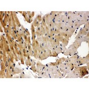 GRK5 Antibody - GRK5 antibody IHC-paraffin. IHC(P): Rat Cardiac Muscle Tissue.