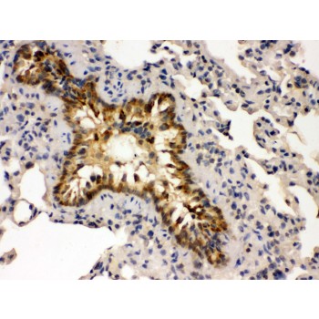 GRK5 Antibody - GRK5 antibody IHC-paraffin. IHC(P): Mouse Lung Tissue.