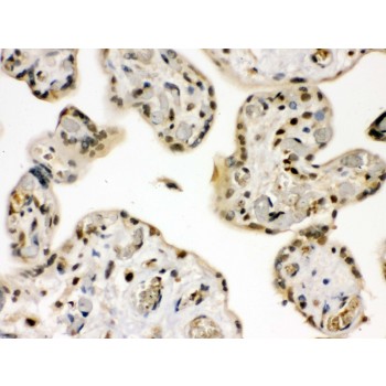 GRK5 Antibody - GRK5 antibody IHC-paraffin. IHC(P): Human Placenta Tissue.