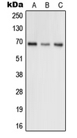 GRK5 Antibody - Western blot analysis of GRK5 expression in H9C2 (A); HEK293T (B); HeLa (C) whole cell lysates.