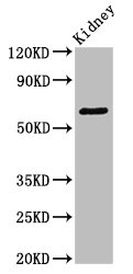 GRK5 Antibody - Positive Western Blot detected in Mouse kidney tissue. All lanes: GRK5 antibody at 3.4 µg/ml Secondary Goat polyclonal to rabbit IgG at 1/50000 dilution. Predicted band size: 68 KDa. Observed band size: 68 KDa