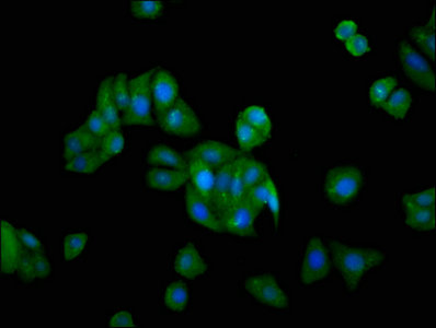 GRK5 Antibody - Immunofluorescence staining of HepG2 cells with GRK5 Antibody at 1:166, counter-stained with DAPI. The cells were fixed in 4% formaldehyde, permeabilized using 0.2% Triton X-100 and blocked in 10% normal Goat Serum. The cells were then incubated with the antibody overnight at 4°C. The secondary antibody was Alexa Fluor 488-congugated AffiniPure Goat Anti-Rabbit IgG(H+L).