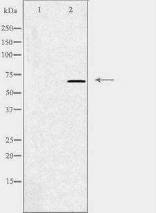 GRK5 Antibody - Western blot analysis of extracts of HuvEc cells using GRK5 antibody. The lane on the left is treated with the antigen-specific peptide.