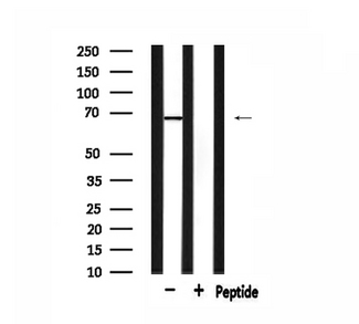 GRK5 Antibody - Western blot analysis of extracts of 293 cells using GRK5 antibody.