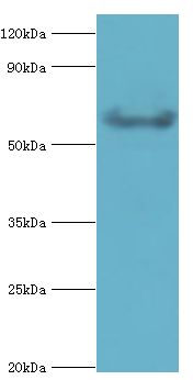 GRK6 Antibody - Western blot. All lanes: G protein-coupled receptor kinase 6 antibody at 6 ug/ml+rat heart tissue. Secondary antibody: Goat polyclonal to rabbit at 1:10000 dilution. Predicted band size: 66 kDa. Observed band size: 66 kDa Immunohistochemistry.