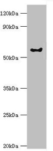 GRK6 Antibody - Western blot All lanes: G protein-coupled receptor kinase 6 antibody at 6µg/ml + Rat heart tissue Secondary Goat polyclonal to rabbit IgG at 1/10000 dilution Predicted band size: 66, 68, 65 kDa Observed band size: 66 kDa