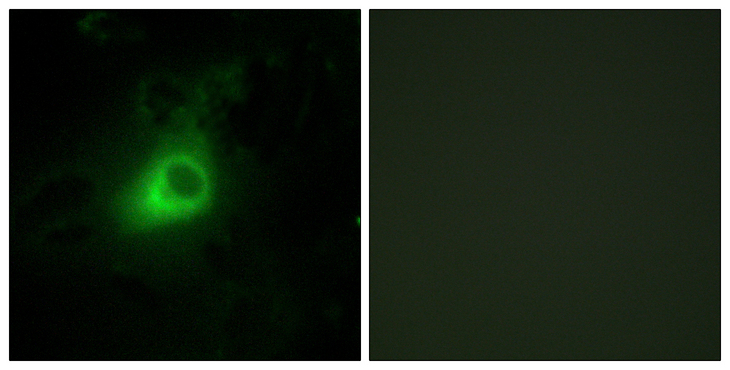GRK6 Antibody - Immunofluorescence analysis of HeLa cells, using GRK6 Antibody. The picture on the right is blocked with the synthesized peptide.