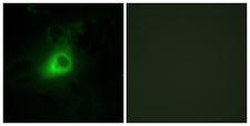 GRK6 Antibody - Immunofluorescence analysis of HeLa cells, using GRK6 Antibody. The picture on the right is blocked with the synthesized peptide.