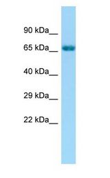 GRK6 Antibody - GRK6 antibody Western Blot of Fetal Bladder.  This image was taken for the unconjugated form of this product. Other forms have not been tested.
