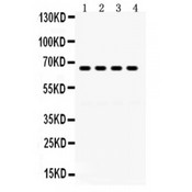 GRK6 Antibody - GRK6 antibody Western blot. All lanes: Anti GRK6 at 0.5 ug/ml. Lane 1: Rat Lung Tissue Lysate at 50 ug. Lane 2: HELA Whole Cell Lysate at 40 ug. Lane 3: K562 Whole Cell Lysate at 40 ug. Lane 4: JURKAT Whole Cell Lysate at 40 ug. Predicted band size: 66 kD. Observed band size: 66 kD.