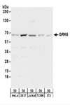 GRK6 Antibody - Detection of Human and Mouse GRK6 by Western Blot. Samples: Whole cell lysate (50 ug) from HeLa, 293T, Jurkat, mouse TCMK-1, and mouse NIH3T3 cells. Antibodies: Affinity purified rabbit anti-GRK6 antibody used for WB at 0.1 ug/ml. Detection: Chemiluminescence with an exposure time of 30 seconds.