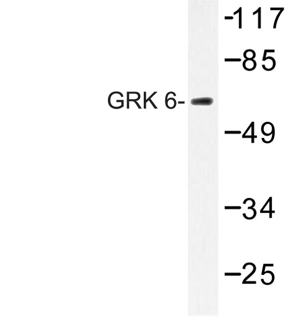 GRK6 Antibody - Western blot of GRK 6 (N22) pAb in extracts from Jurkat cells.