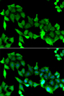 GRK6 Antibody - Immunofluorescence analysis of A549 cells.