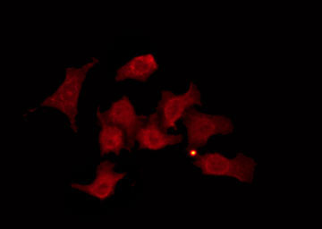 GRK6 Antibody - Staining HeLa cells by IF/ICC. The samples were fixed with PFA and permeabilized in 0.1% Triton X-100, then blocked in 10% serum for 45 min at 25°C. The primary antibody was diluted at 1:200 and incubated with the sample for 1 hour at 37°C. An Alexa Fluor 594 conjugated goat anti-rabbit IgG (H+L) Ab, diluted at 1/600, was used as the secondary antibody.