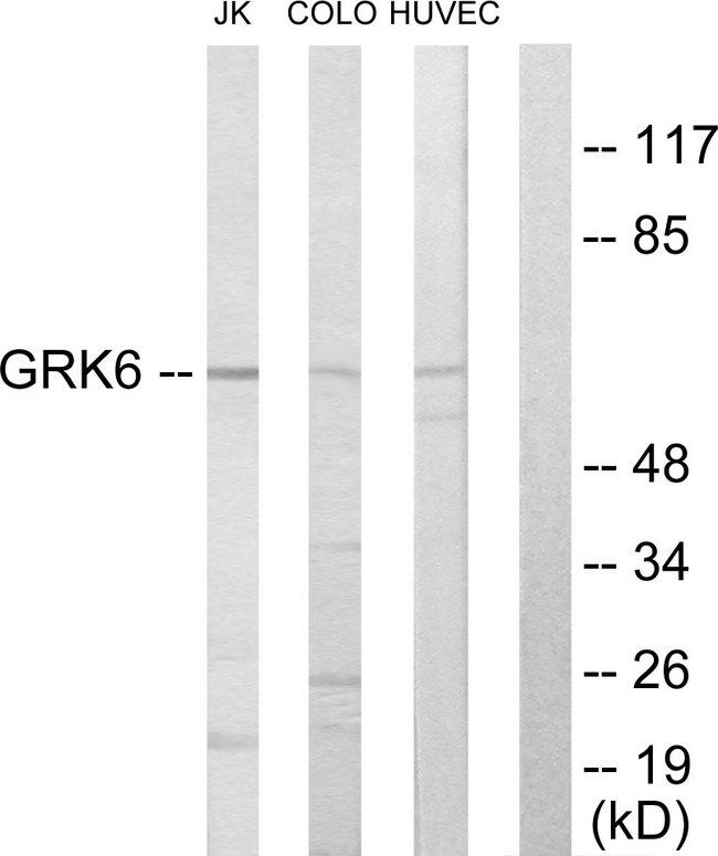 GRK6 Antibody - Western blot analysis of extracts from Jurkat cells, COLO205 cells and HUVEC cells, using GRK6 antibody.