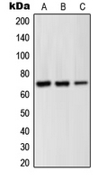 GRK6 Antibody - Western blot analysis of GRK6 expression in Jurkat (A); BJAB (B); Ramos (C) whole cell lysates.