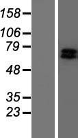 GRK6 Protein - Western validation with an anti-DDK antibody * L: Control HEK293 lysate R: Over-expression lysate