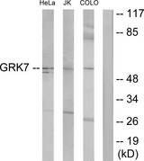 GRK7 / GPRK7 Antibody - Western blot analysis of lysates from COLO205, Jurkat, and HeLa cells, using GRK7 Antibody. The lane on the right is blocked with the synthesized peptide.
