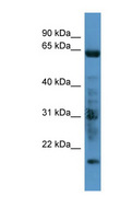 GRK7 / GPRK7 Antibody - GRK7 antibody Western blot of Fetal Heart lysate.  This image was taken for the unconjugated form of this product. Other forms have not been tested.