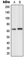 GRK7 / GPRK7 Antibody - Western blot analysis of GPK7 expression in Y79 (A); human heart (B) whole cell lysates.