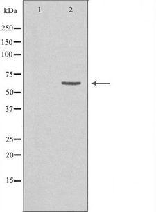 GRK7 / GPRK7 Antibody - Western blot analysis of extracts of HeLa cells using GRK7 antibody. The lane on the left is treated with the antigen-specific peptide.