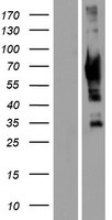 GRK7 / GPRK7 Protein - Western validation with an anti-DDK antibody * L: Control HEK293 lysate R: Over-expression lysate