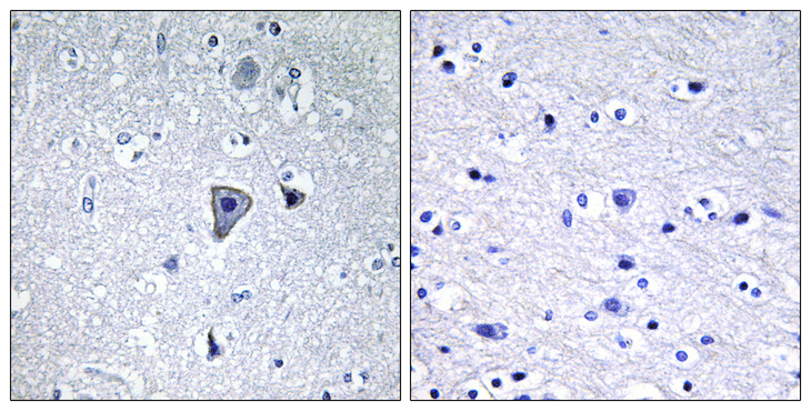 GRM1 / MGLUR1 Antibody - Immunohistochemistry analysis of paraffin-embedded human brain tissue, using GRM1 Antibody. The picture on the right is blocked with the synthesized peptide.
