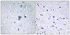 GRM1 / MGLUR1 Antibody - Immunohistochemistry analysis of paraffin-embedded human brain tissue, using GRM1 Antibody. The picture on the right is blocked with the synthesized peptide.