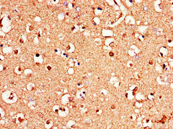 GRM1 / MGLUR1 Antibody - Immunohistochemistry of paraffin-embedded human brain tissue using GRM1 Antibody at dilution of 1:100