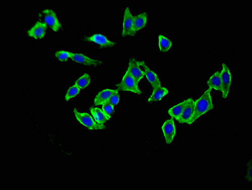 GRM1 / MGLUR1 Antibody - Immunofluorescent analysis of HepG2 cells using GRM1 Antibody at a dilution of 1:100 and Alexa Fluor 488-congugated AffiniPure Goat Anti-Rabbit IgG(H+L)
