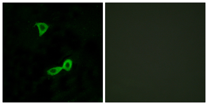 GRM2 / MGLUR2 Antibody - Immunofluorescence analysis of LOVO cells, using GRM2 Antibody. The picture on the right is blocked with the synthesized peptide.