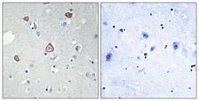 GRM2 / MGLUR2 Antibody - Immunohistochemistry analysis of paraffin-embedded human brain tissue, using GRM2 Antibody. The picture on the right is blocked with the synthesized peptide.