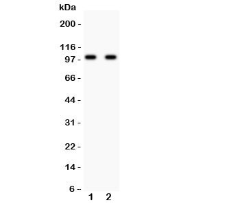GRM2 / MGLUR2 Antibody - Western blot testing of GLUR2 antibody and Lane 1: rat brain; 2: mouse brain lysate. Predicted/observed size ~99KD