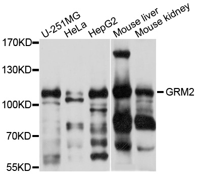 GRM2 / MGLUR2 Antibody - Western blot analysis of extracts of various cell lines, using GRM2 antibody at 1:1000 dilution. The secondary antibody used was an HRP Goat Anti-Rabbit IgG (H+L) at 1:10000 dilution. Lysates were loaded 25ug per lane and 3% nonfat dry milk in TBST was used for blocking. An ECL Kit was used for detection and the exposure time was 1s.