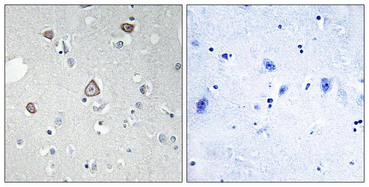 GRM2 / MGLUR2 Antibody - Peptide - + Immunohistochemistry analysis of paraffin-embedded human brain tissue using GRM2 antibody.
