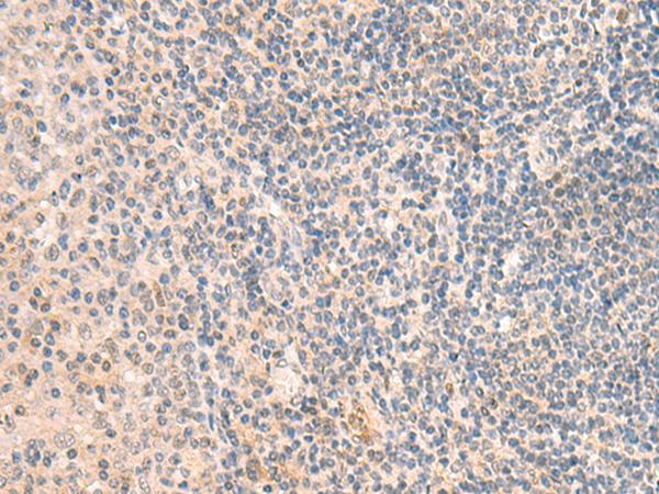GRM2 / MGLUR2 Antibody - Immunohistochemistry of paraffin-embedded Human tonsil tissue  using GRM2 Polyclonal Antibody at dilution of 1:50(×200)