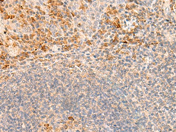 GRM2 / MGLUR2 Antibody - Immunohistochemistry of paraffin-embedded Human tonsil tissue  using GRM2 Polyclonal Antibody at dilution of 1:35(×200)