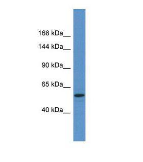 GRM3 / MGLUR3 Antibody - Western blot of Human NCI-H226. GRM3 antibody dilution 1.0 ug/ml.  This image was taken for the unconjugated form of this product. Other forms have not been tested.