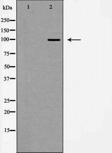 GRM3 / MGLUR3 Antibody - Western blot analysis of GluR2/3 expression in mouse brain. The lane on the left is treated with the antigen-specific peptide.