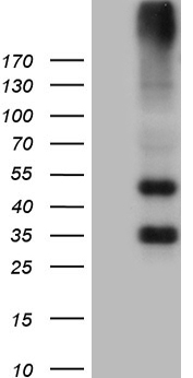 GRM4 / MGLUR4 Antibody - HEK293T cells were transfected with the pCMV6-ENTRY control. (Left lane) or pCMV6-ENTRY GRM4. (Right lane) cDNA for 48 hrs and lysed. Equivalent amounts of cell lysates. (5 ug per lane) were separated by SDS-PAGE and immunoblotted with anti-GRM4. (1:2000)